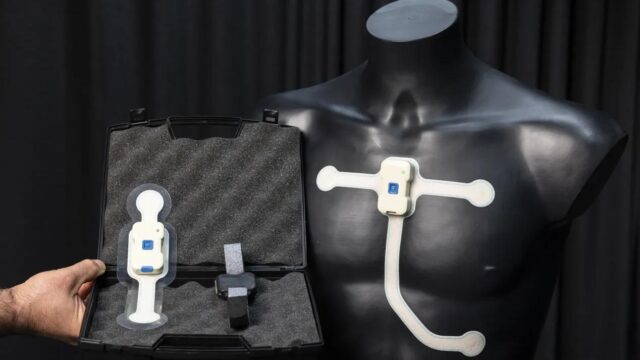 Wearable sensors for dialysis